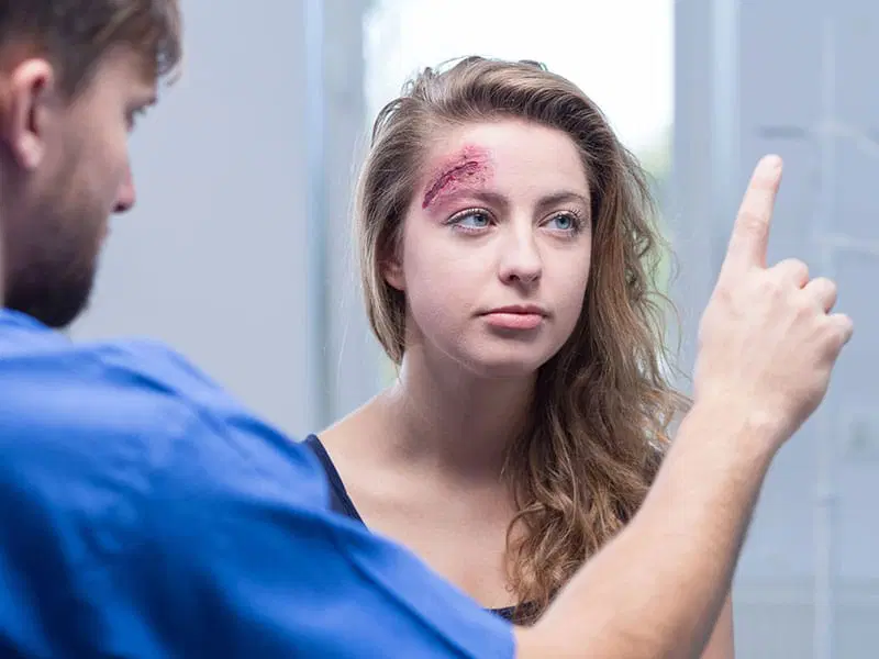 A young woman with a visible forehead injury has her eye movement tested by a medical professional holding up a finger.