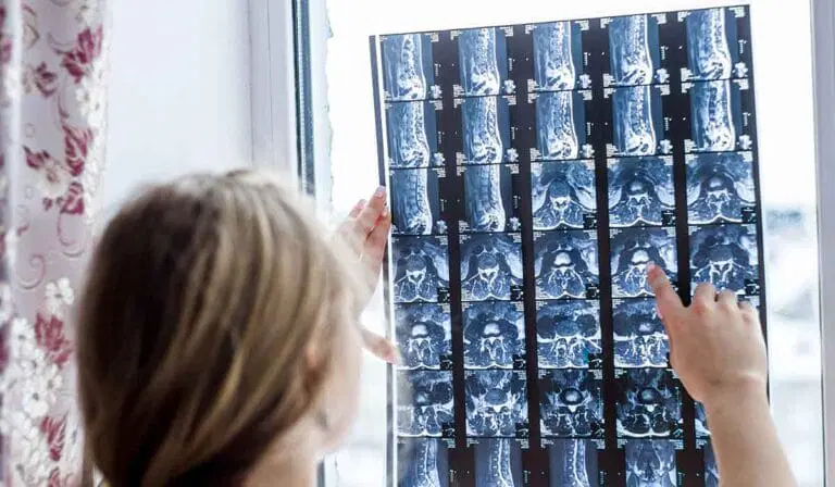 A person holds up and examines a set of spinal MRI scans against a window, using natural light to view the details in the images.